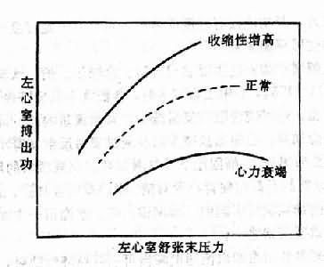 心功能曲线示意图