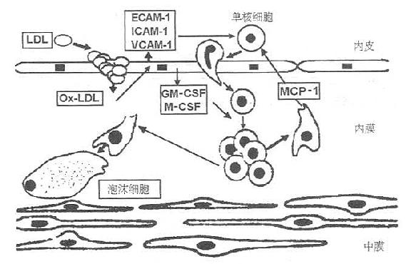 单核细胞源泡沫细胞的产生