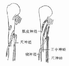 利用尺神经修复桡神经、正中神经和肌皮神经