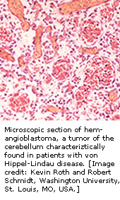 在第三条染色体上VHL基因表达