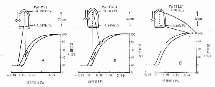 胸腔内压对通气分布的影响