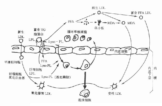 动脉粥样硬化发生机制假说