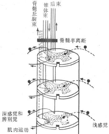 脊髓半离断效应示意图