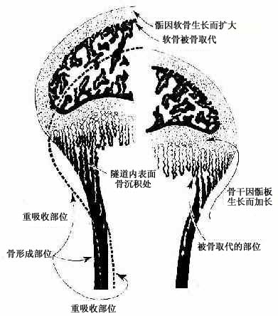 骨干骨密质形成和外形变化及骨骺发育示意图 