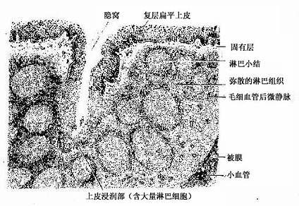 腭扁桃体 