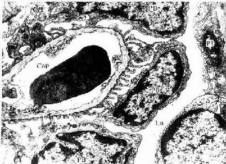 肾小体电镜像 